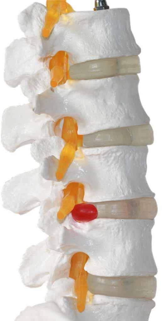 Spina Luminosa con pelvico - - Modello pelvico anatomico Medico - Monouso - Modello con la Colonna vertebrale - Peridi Studio