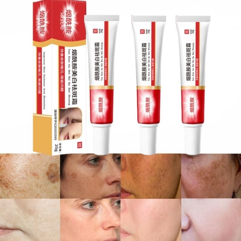 3Pcs Crema para Manchas Oscuras en La Cara, Crema para Las Manchas de La Cara 20g, Face Moisturizer Cream
