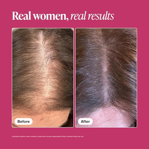 Image of Hair Growth Supplements for Women for Thicker, Fuller Hair, Nourishes Thinning & Loss, with Proprietary Collagen Complex