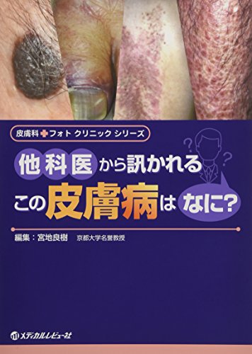 無料電子書籍 アプリ 他科医から訊かれるこの皮膚病はなに? (皮膚科フォトクリニックシリーズ) バイ