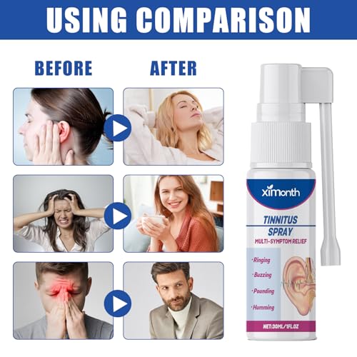 3Pcs Tinnitus SprayOhrenschmalz Entferner Spray Hearing Aid Spray Qartel Ohrenspray Ohrenreiniger Spray Tinnitus Relief Spray Hearing Restoration Spray Lindert Tinnitus Gehör Verbessern(30ml)