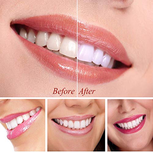 Professional Teeth Whitening Kit,Teeth Whitening Gel,Home Teeth Whitening Kit,Tooth Whiten Gel Dental Care Home Professional Bleaching Kit Light Dental Whitening Kit