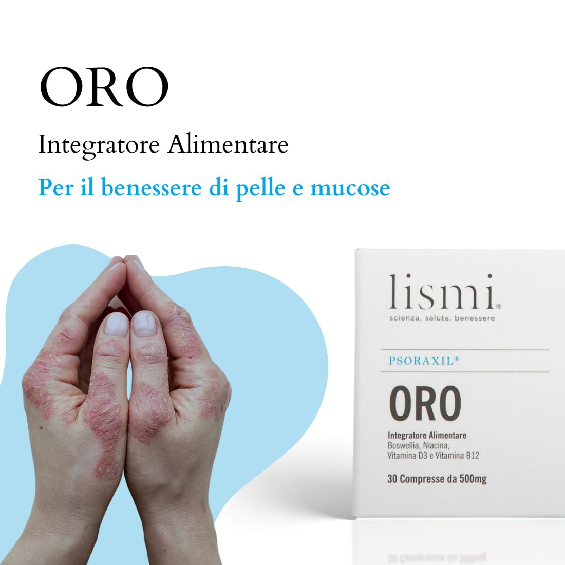PSORAXIL ORO - Integratore per la Psoriasi, per il Benessere della Pelle e Mucose, Infiammazioni e Alterazioni Cutanee, Dona Protezione Osteo-Articolare, Made in Italy, Confezione da 30 Compresse