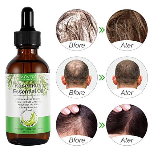 Miniatura 4 de Aceite De Romero Para El Crecimiento Del Cabello 2 Paquetes, Cuidado De La Piel, Aceite Para El Tratamiento De La Caída Del Cabello Para Mujeres Y Hombres, Nutre El Cuero Cabelludo