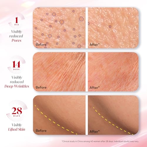 Image of Olay Regenerist Ultra Firming Serum | PHCA, Bakuchiol, Collagen Peptide | Firm and Smooth Skin from Day 1 | Lightweight Texture | Dermatologist Tested | All Skin Types Including Sensitive Skin | 30ml