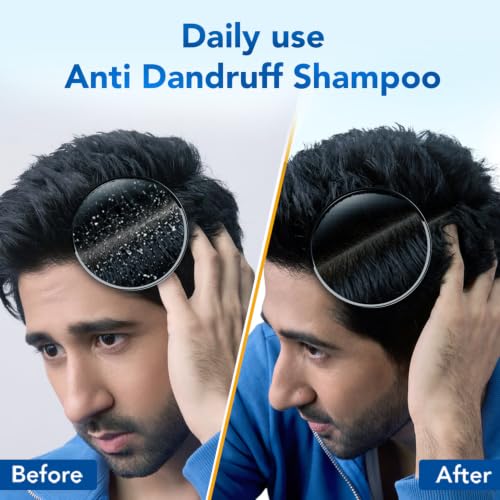 Image of Scalpe Pro Daily Anti-Dandruff Shampoo | Removes Dandruff from Source | Prevents Itching & Irritation | Scalpe Science | Climbazole Formulation | Dermatologically Tested | For Women & Men | 200ml