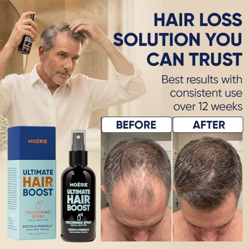 Moerie Hair Growth Serum Spray for Men and Women, Hair Loss Solution with Biotin and Rosemary, Thickening Serum for Hair Regrowth and Thinning Hair - Ultimate Scalp and Growth Care - Image 5