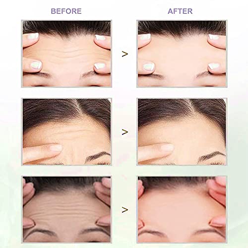 Anti Falten Stirn Pad,Facial Patches,Forehead Wrinkle Patches,Anti Aging Gesichts Anti-Falten-Patches,Antifaltenpflaster,Anti Falten Anti Stirnfaltenhaut Feuchtigkeitsspendende Reparatur,5 Stück