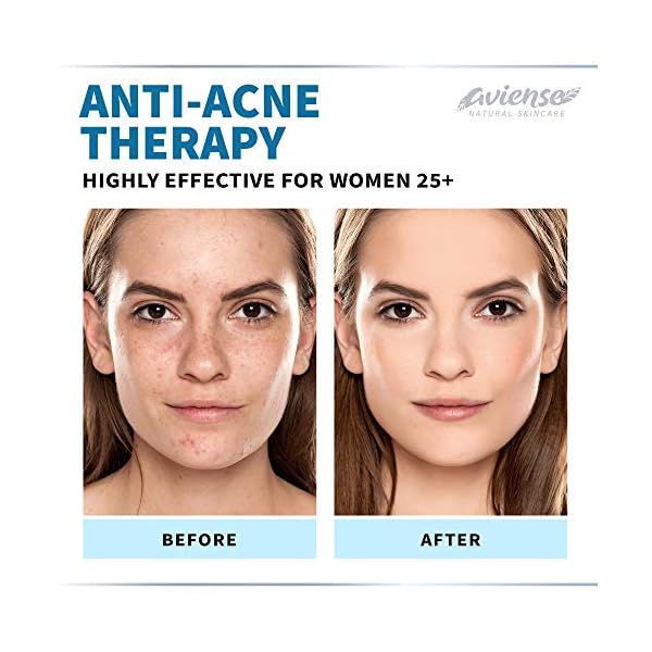 Anti Wrinkle Cream for Face - Retinol & Collagen Anti Aging Cream - Made in USA - Fine Lines & Wrinkle Repair - Retinol Cream for Face with Hyaluronic Acid Vitamin E - Face Moisturizer for Women & Men