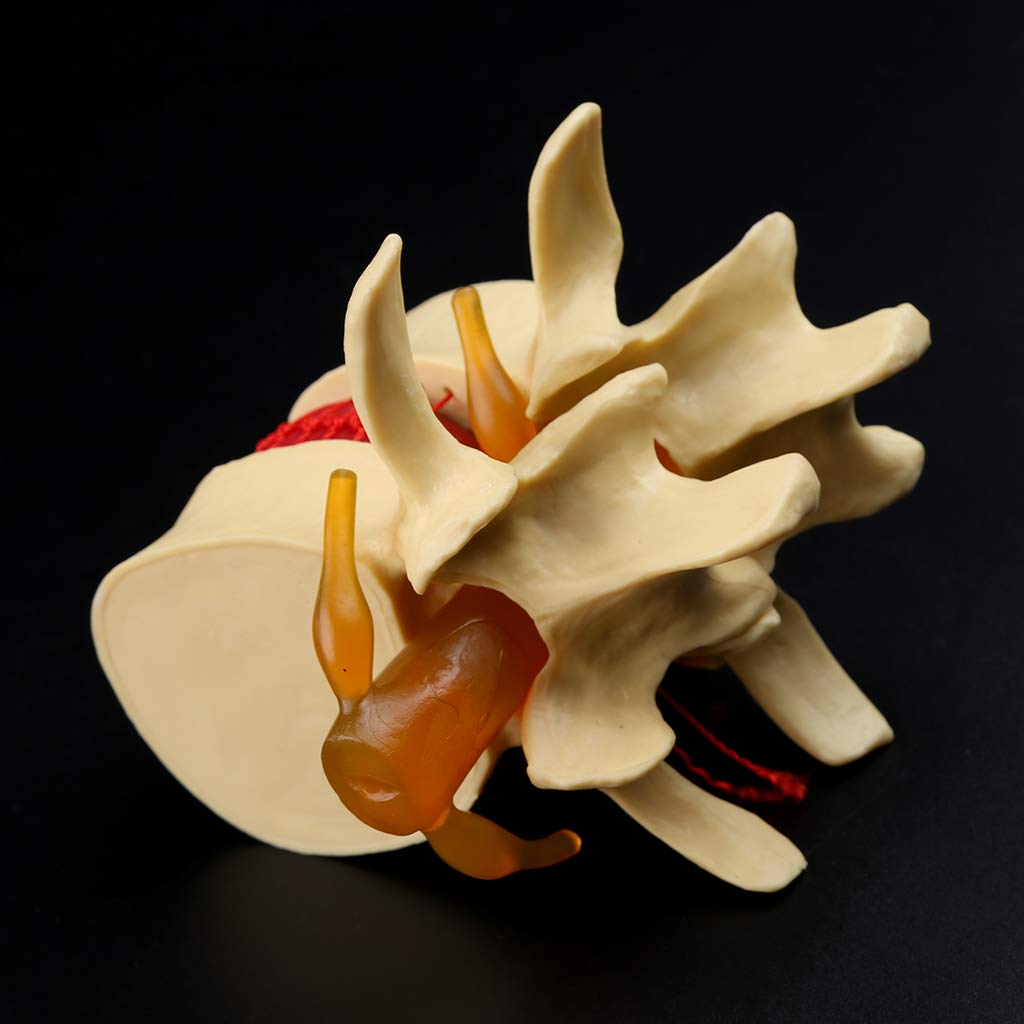 Anatomia Człowieka, Kręgosłup, Przepuklina Kręgosłupa Lędźwiowego, Tryb Nauczania, Czaszka, Uraz, Sprzęt Szkolny, Tryb Nauczania