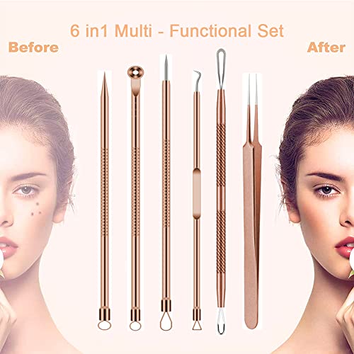 Outils points noirs efficaces contre acné et imperfections - 7