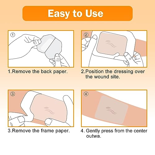 Image of Carbou Transparent Film Dressing, 2.36 inch x 2.75 inch, Pack of 100