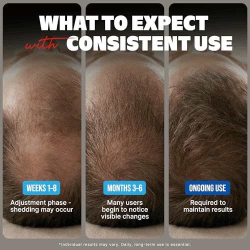 Image of Minoxidil Liquid Extra Strength Hair Regrowth Treatment for Men, 5% Topical Solution, 6 Months Supply - Dropper Applicator and Bonus Free Instructional Guide Included