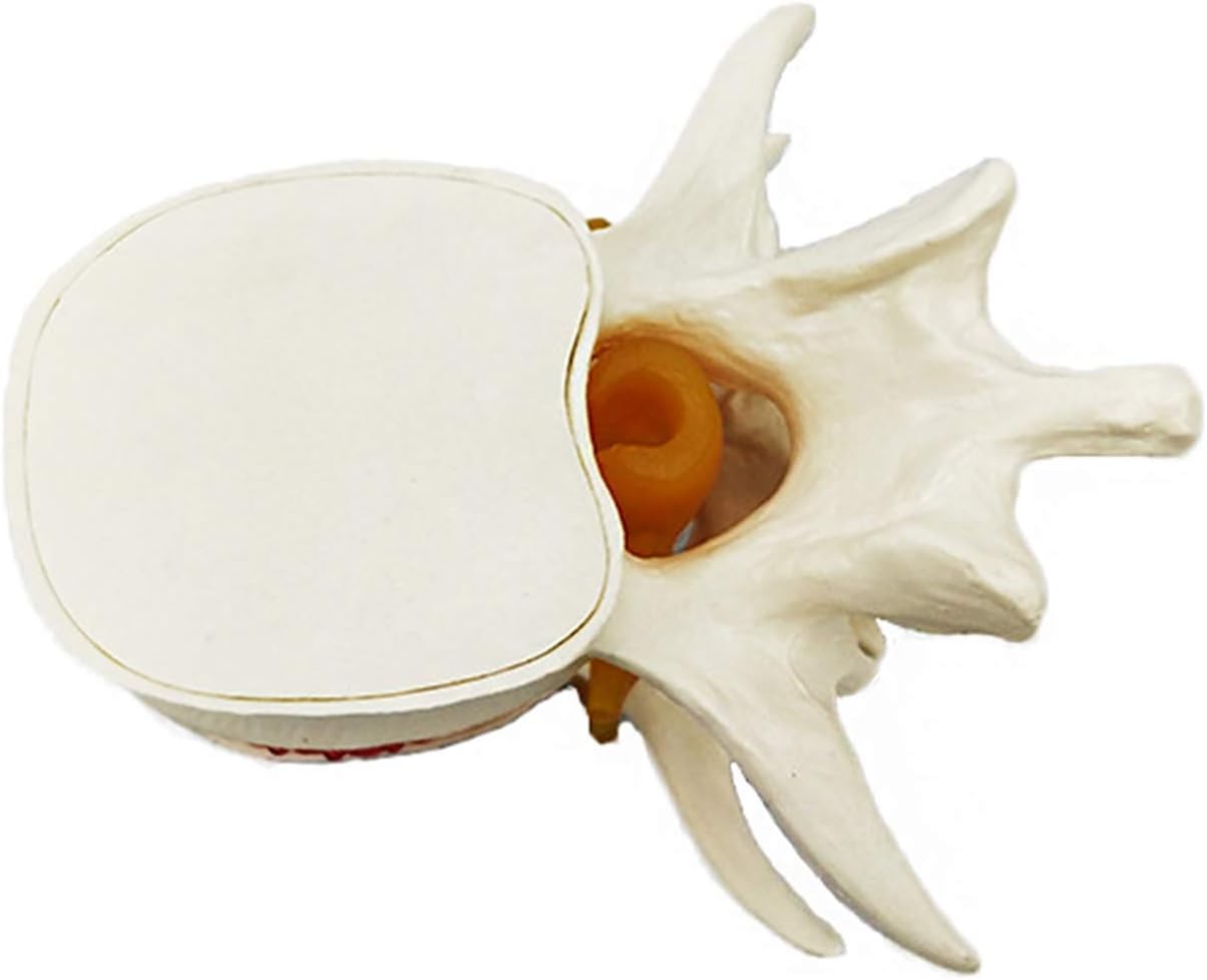 Modello di Dimostrazione del Disco Lombare Umano Modello della Colonna Sonora del Dorso Giallo Umano Colonna Lombare Anatomica Colonna Vertebrale Lombare