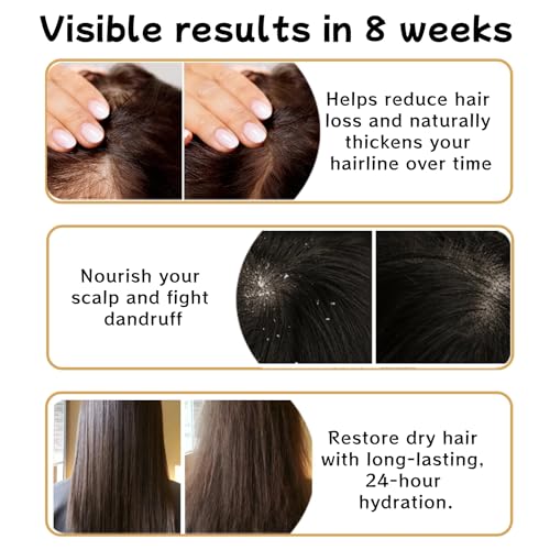 FLEXQW 1 PCS Anti Hair Loss Shampoo, Promote Hair Growth and Thickening & Strengthening Shampoo with Various Plant Extracts for Thinning Hair Women（300ml） — view 3