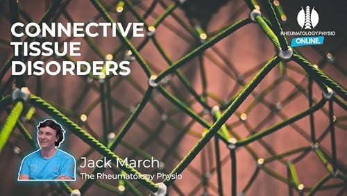 Exercise Intolerance In Lupus Podcast Por  arte de portada