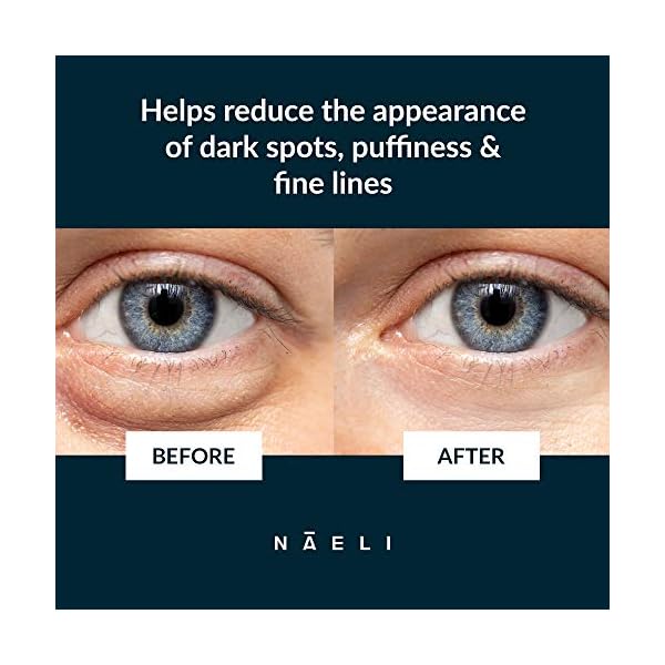 Eye-Cream-for-Dark-Circles-Puffiness-Wrinkles-with-Anti-Aging-Apple-Stem-Cell-Peptide-Complex-Reduces-Fine-Lines-Diminishes-Bags-Restores-Under-Eye-14-oz NAELI Eye Cream for Dark Circles, Puffiness & Wrinkles with Anti Aging Apple Stem Cell & Peptide Complex - Reduces Fine Lines, Diminishes Bags & Restores Under Eye, 1.4 oz