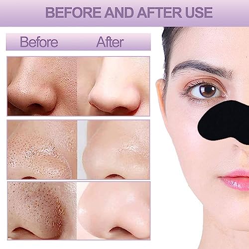 Image of Woffely Skincare Cleansing Charcoal Nose Strips for Women and man- Blackhead Remover & Pore Cleanser (20 Strips)