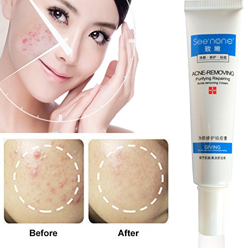 anti acne scar