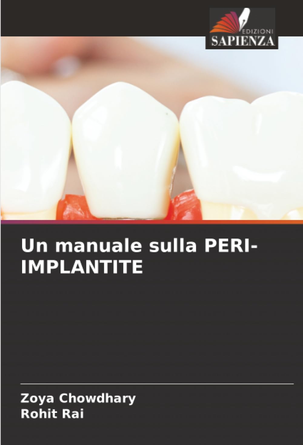 Un manuale sulla PERI-IMPLANTITE
