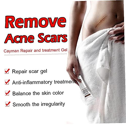 Littekenverwijdering Cream Acne Markeringen Remover Gel Skin Reparatie Burns Acne Spots Behandeling Optimale Restauratie… - Image 6