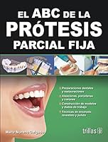 El ABC de la prótesis parcial fija / The ABCs of fixed partial denture (Spanish Edition) 6071708192 Book Cover