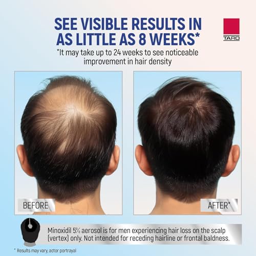 Image of TARO Minoxidil for Men Topical Aerosol Foam 5%, 2.11 Oz 2.11 Ounce (Pack of 3)
