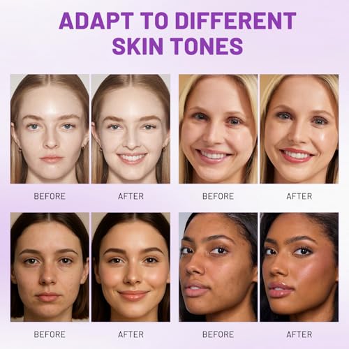 Image of Soft Matte Cream Concealer Palette | 8 Shades | Waterproof Full Coverage | Long Lasting Lightweight Formula | with Applicator for Blemishes Cover (Medium+Light)