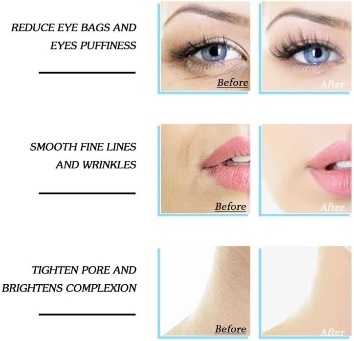 Ice Roller for Face & Body - Cold Therapy Tool to Depuff Eyes, Reduce Inflammation & Tighten Skin - with Protective Case (Blue) - Image 7