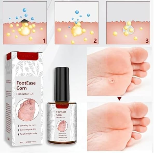 Image of Corn Ease Foot Eliminator Gel | Fast-Acting, Pain-Free Corn & Callus Remover | Gentle Formula for Soft, Smooth Feet | Effective Corn Treatment Gel for Men & Women | 30ml (3)