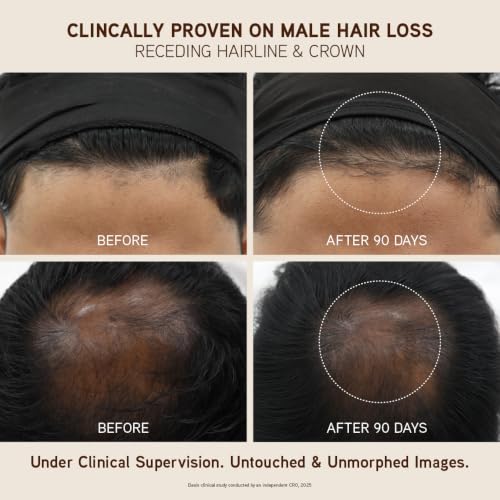 Indulekha Ayurvedic Hair Growth Oil 250ml - Image 5