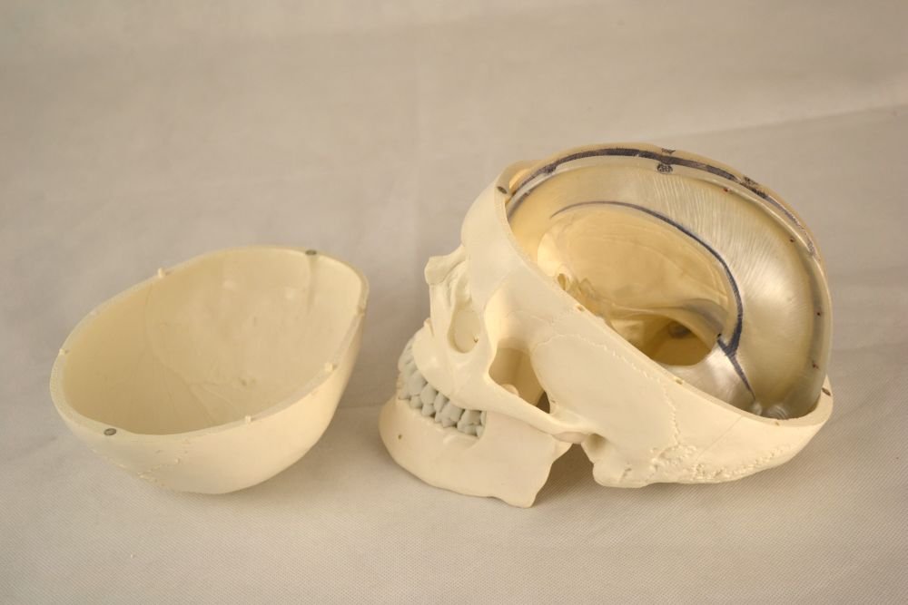 Wellden Medical Human Skull with Dura Mater and Cranial Sinuses