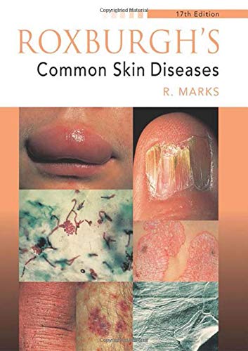 Buy Roxburgh's Common Skin Diseases — BookShops.in