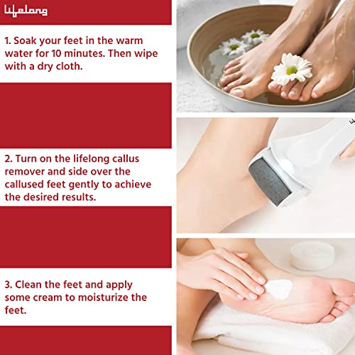 Lifelong-LLPCW04-Rechargeable-Pedicure-Device-for-Callus-Dead-Skin-Removal-Feet-Care-Pedicure-kit-for-women-for-foot-Feet-Callus-Remover-at-Home-1-Year-Warranty-White