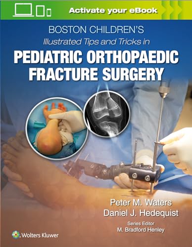 Boston Children’s Illustrated Tips and Tricks in Pediatric Orthopaedic Fracture Surgery