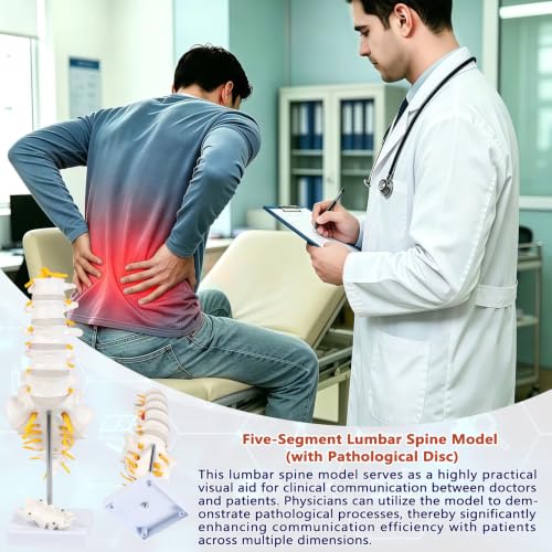 Image of 5 Section Lumbar Spine Model with Sacrum and Spinal Nerves,Life Size Vertebral Column Model for Chiropractic,Patient Education Demonstration,Excellent Way for Demonstrating Disc