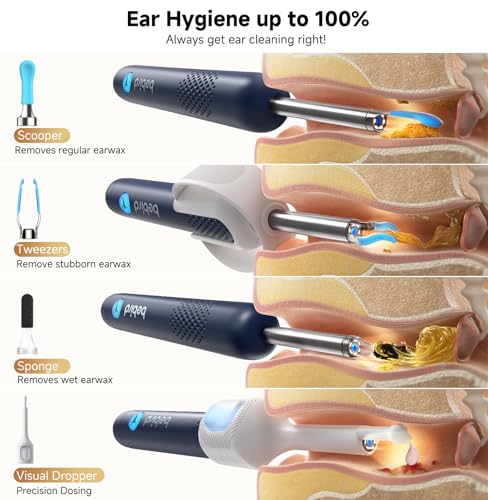 Image of BEBIRD R1 Ultra Ear Wax Remova, Ear Cleaner with Camera Ear Scope, Wax Remove Ear Pick with Ear Otoscope Tweezers, Visual Dropper Cleaning Kit, Ear /Nose /Throat Examination Tool for Family, Blue