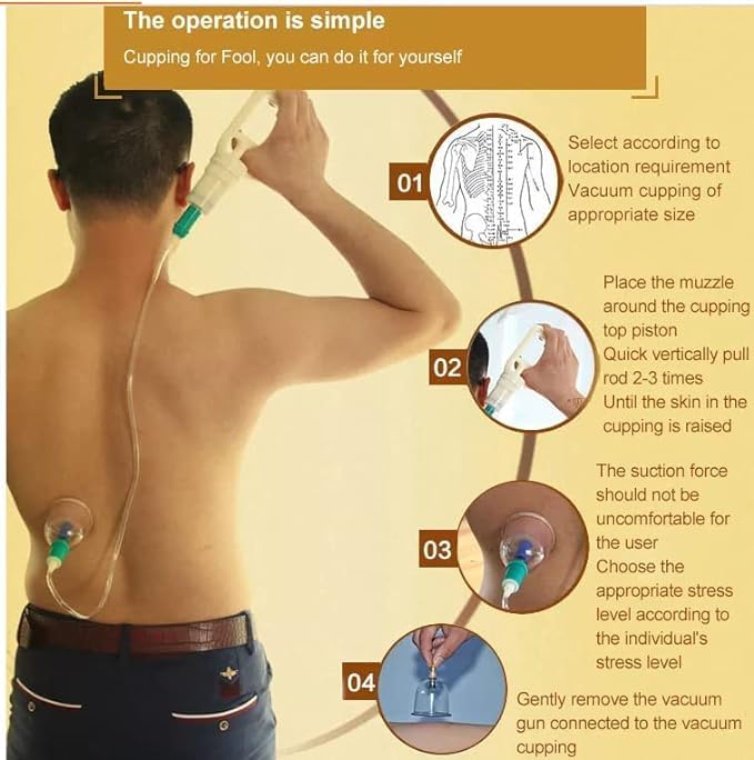 Image of SUJOK Hijama Cupping Kit Set 12 Pcs Vacuum Cupping Set Health Care Vacuum Cupping Portable Body Relaxation Massage Therapy Kit (Kangji Cupping Set 12)