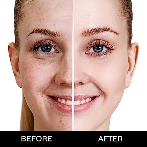 FACESCANADA Weightless Matte Finish Foundation - Ivory, 15ml | Lightweight | Natural Finish | Anti-Ageing | Non-Clog Pores | Enriched With Olive Seed Oil, Grape Extract, Shea... - Image 3