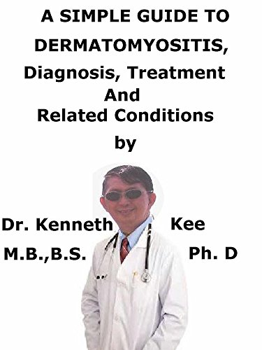 A Simple Guide To Dermatomyositis, Diagnosis, Treatment And Related Conditions (A Simple Guide to Medical Conditions) (English Edition)
