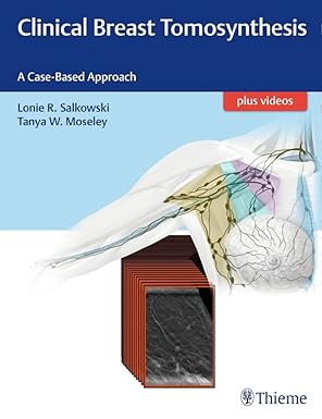 Clinical Breast Tomosynthesis: A Case-Based Approach