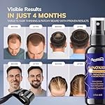 5% Minoxidil Kit for Men and Women with 0.25 mm Derma Roller – Beard Growth Kit & Hair Regrowth Spray – Targets Thinning Hairlines, Crowns & Patchy Beards – 60 mL - Image 2
