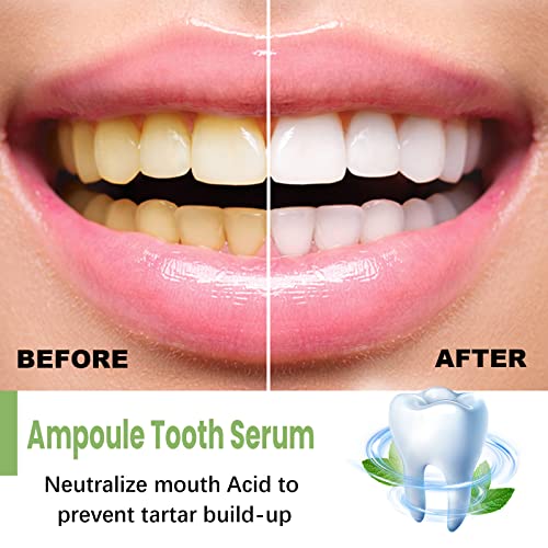 2023 New Tlopa Ampullen Zahnpasta,Tlopa Ampoule Toothpaste,Removal Of Tartar And Plaque,Tlopa Ampoule Tooth Serum,3V Fruit Acid Teeth Whitening Essence Toothpaste (20 Pcs/2 Box) #TOP5