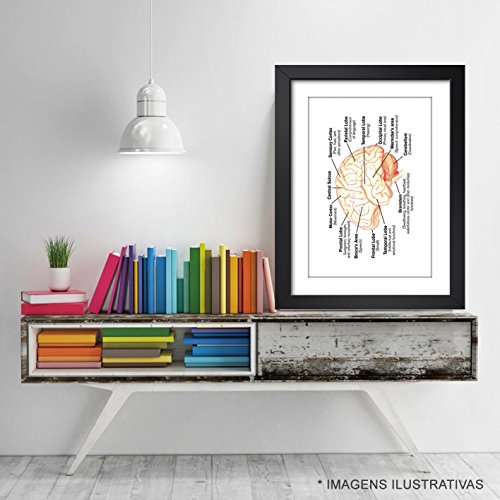 Quadro Medicina Anatomia Cerebro Humano Medico Decorativo Clinica Hospital Consultorio Moldura e Pas