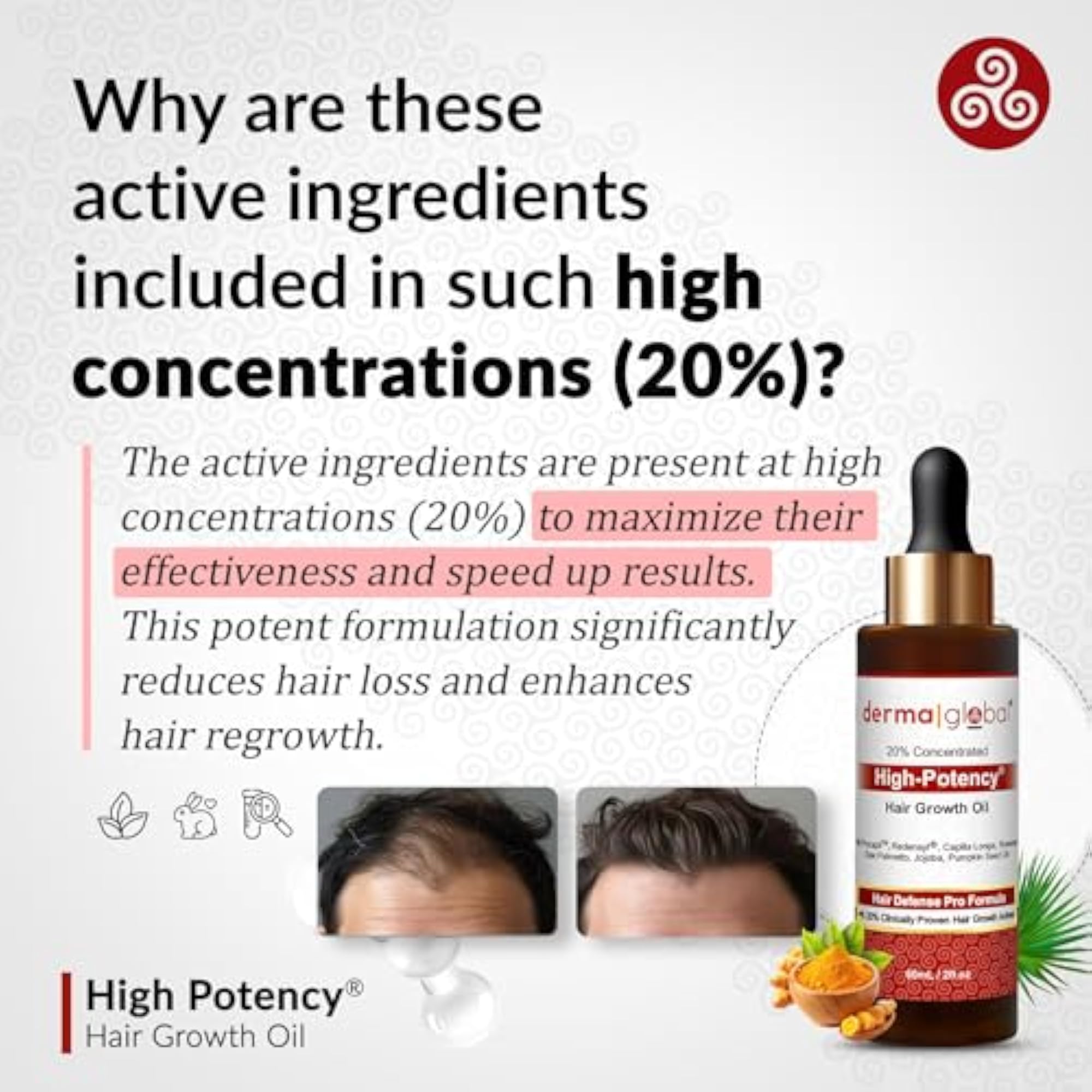 High Potency Hair Growth Oil for Men & Women, 200ml