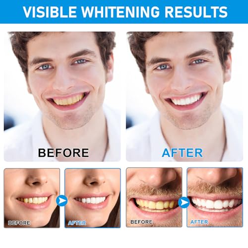 Image of Tooth Powder Remineralizing, Remineralizing Teeth Restoration, Natural Organic, Gums, Oral Care, Fresh Breath（Mineral Tooth Powder 1PCS）