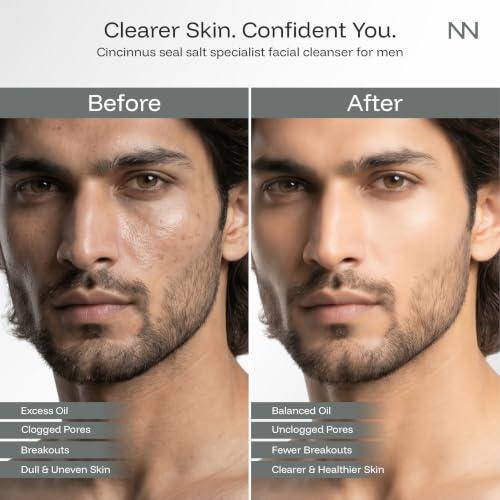 Image of Cincinnus Oil Control & Moisturizing Facial Cleanser for Men | Deep Cleansing Face Wash with Sea Salt, Centella & Salicylic Acid | Controls Excess Oil | for Oily & Acne-Prone Skin | 210ml