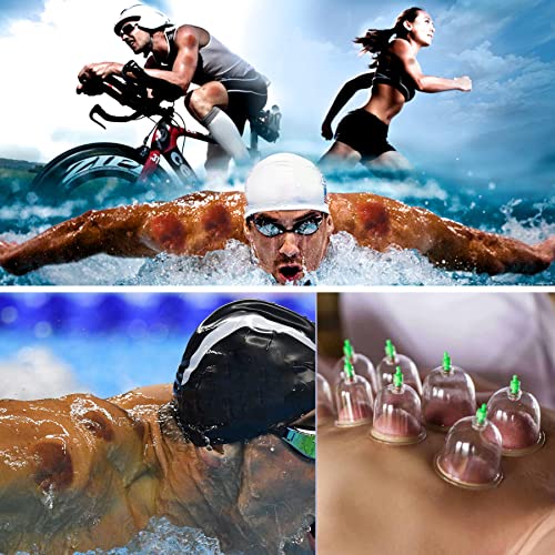 Vonoya 12Pc Cupping Therapy Set, Pump And B2-B7 Suction Cups, Chinese Massage Tool Kit For Tcm Acupoint Therapy Lymphatic Drainage Neck And Back Pain Relief Black #TOP6