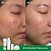 THANKYOU FARMER Phyto Relieful CICA PHA LHA Boosting Toner 7.03 fl oz (200ml), Dermatologist Tested, Alcohol-Free Liquid Exfoliant for Face, Oil-Free Hydrating Toner, Vegan, Fragrance-Free