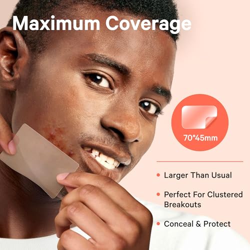 Image of Sosky Large Pimple Patches XL Hydrocolloid Acne Patches for Face & Body Cystic Pimple & Zit Patch for Nose Chin Back, Bacne & Breakouts Vegan Cruelty-Free（10 Count）
